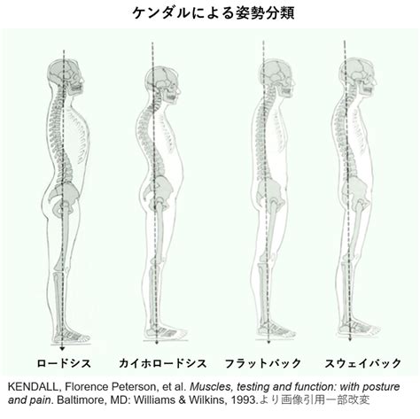 坐位|姿勢の定義と分類の再考